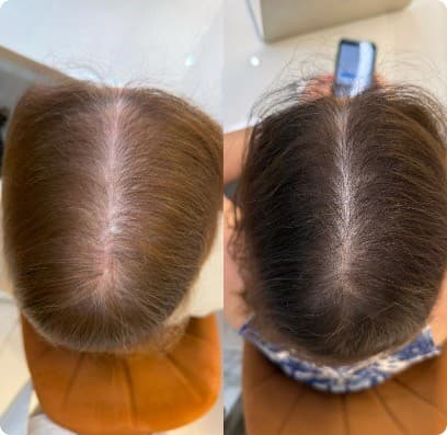 Caso clínico — antes e depois